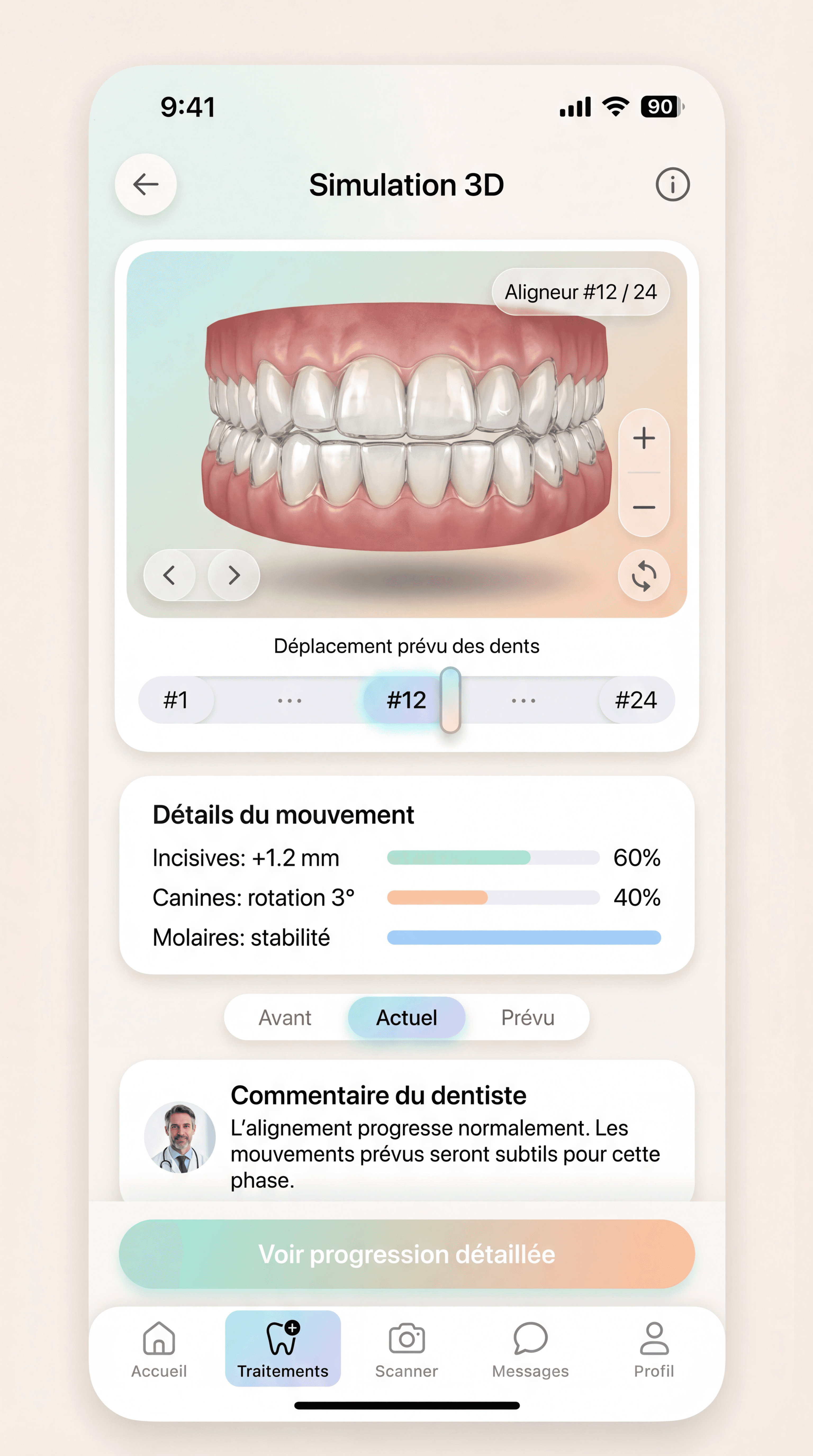 3D tooth simulation mockup